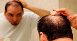 أسباب تؤدي إلى تساقط شعر الرأس